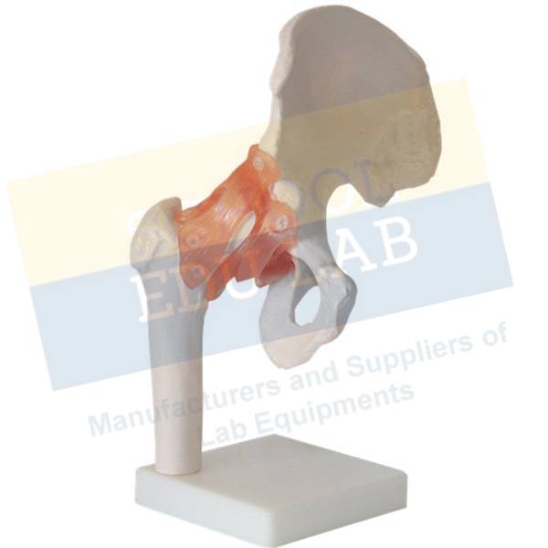 Hip Implants Model