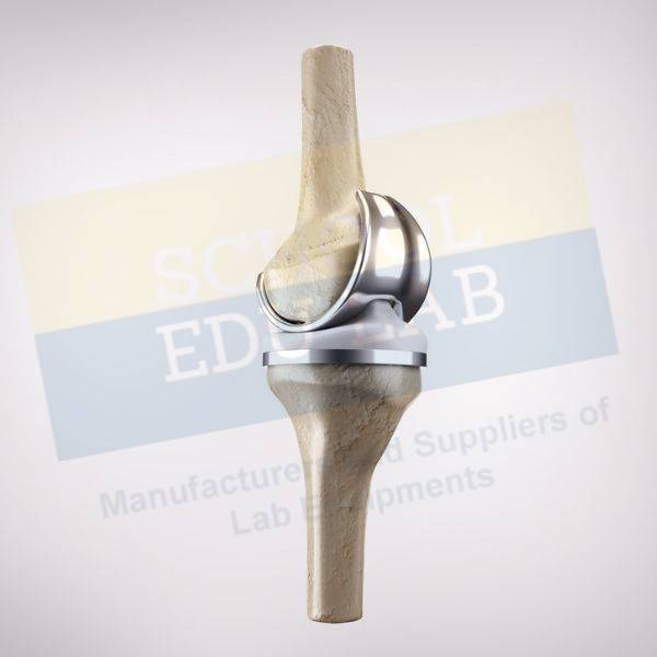 Knee Implant Model