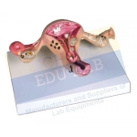 Uterus Model