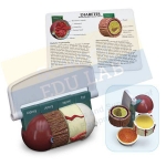 Diabetes Model Set of 4 Piece